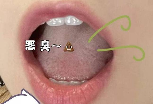 牙齿黄渍去除攻略：天然小窍门与原因解析