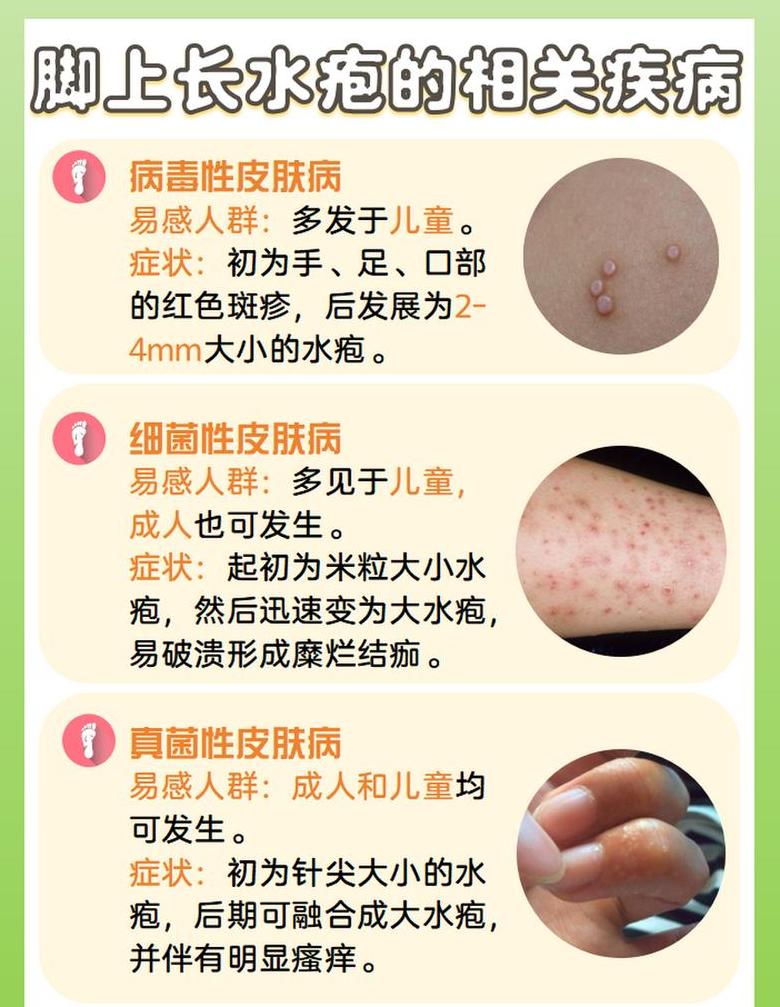 起疱、面疱、疱：全面解读皮肤起疱现象